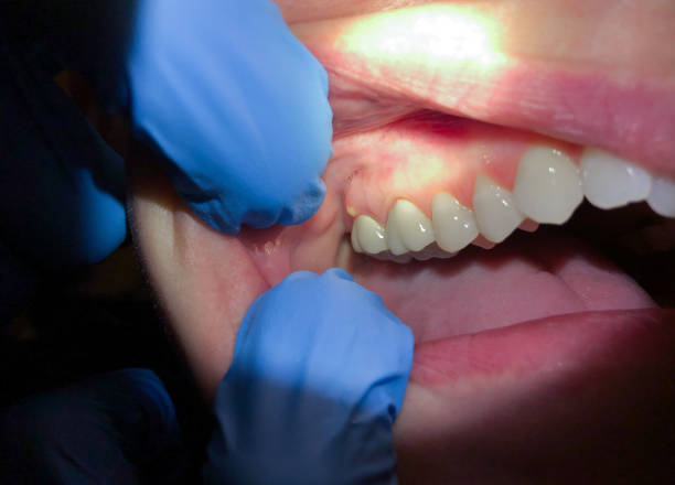 Best 24-Hour Emergency Dental Care in St Johns, MI
