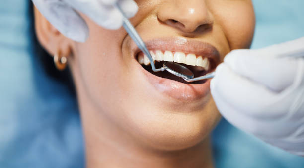 Best Emergency Wisdom Tooth Extraction in St Johns, MI