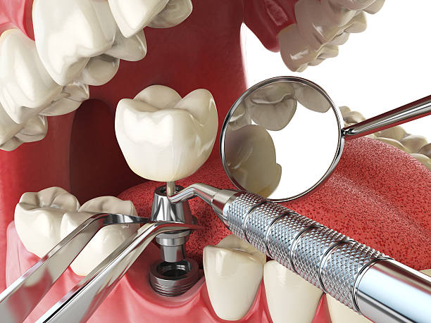 Best Weekend Emergency Dental Services in St Johns, MI
