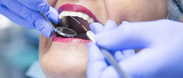 Best Broken or Chipped Tooth Repair in St Johns, MI